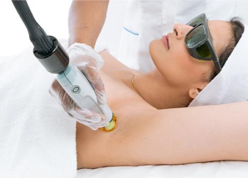 Laser Hair Removal - Is it Safe?
