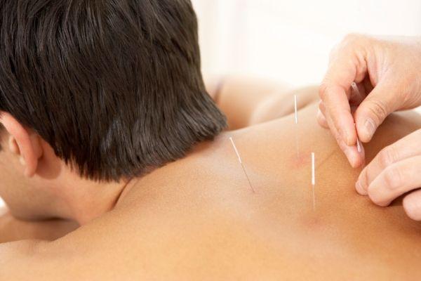 Acupuncture Treatment In Australia