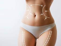 Does Laser Liposuction Produce Lasting Results?