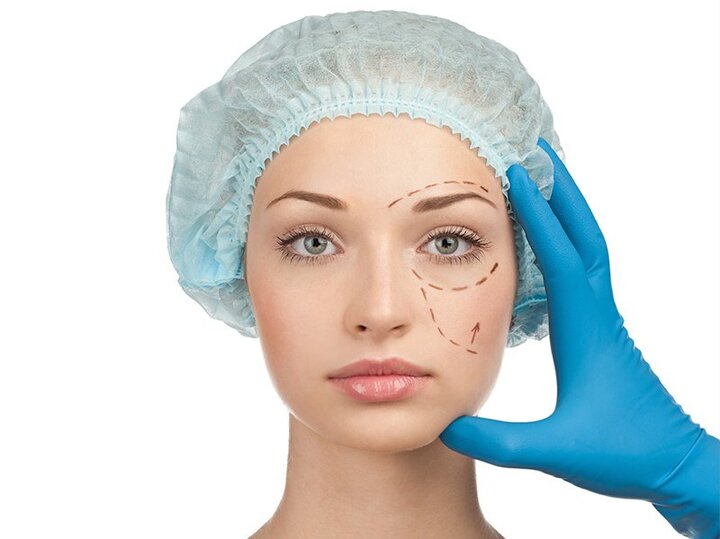 When Should You Consider Getting A Plastic Surgery Done